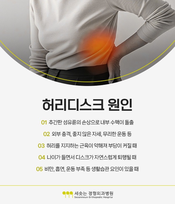 허리디스크증상의 원인 다섯 가지 — 추간판 섬유륜의 손상으로 내부 수핵이 돌출, 외부 충격과 좋지 않은 자세와 무리한 운동, 허리를 지지하는 근육이 약해져 부담이 커질 때, 나이가 들면서 디스크가 자연스럽게 퇴행될 때, 비만과 흡연과 운동 부족 등 생활습관 요인이 있을 때