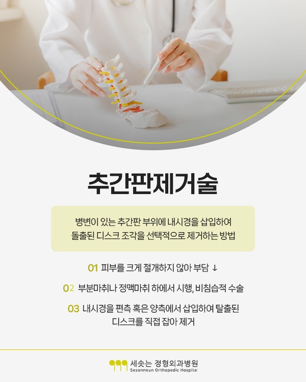 추간판제거술 안내 — 병변이 있는 추간판 부위에 내시경을 삽입하여 돌출된 디스크 조각을 선택적으로 제거하는 방법이며, 피부를 크게 절개하지 않고, 부분마취나 정맥마취 하에서 시행하는 비침습적 수술이며, 내시경을 편측 혹은 양측에서 삽입하여 탈출된 디스크를 직접 잡아 제거한다는 설명