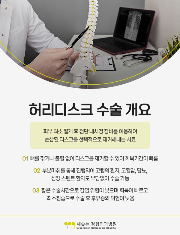 허리디스크 수술 개요 — 피부 최소 절개 후 첨단 내시경 장비를 이용하여 손상된 디스크를 선택적으로 제거해내는 치료라는 설명과, 뼈를 깎거나 출혈 없이 디스크를 제거할 수 있어 회복기간이 빠르다는 점, 부분마취를 통해 진행되어 고령의 환자와 고혈압·당뇨·심장 스텐트 환자도 수술이 가능하다는 점, 짧은 수술시간으로 감염 위험이 낮으며 최소침습으로 수술 후 후유증의 위험이 낮다는 안내